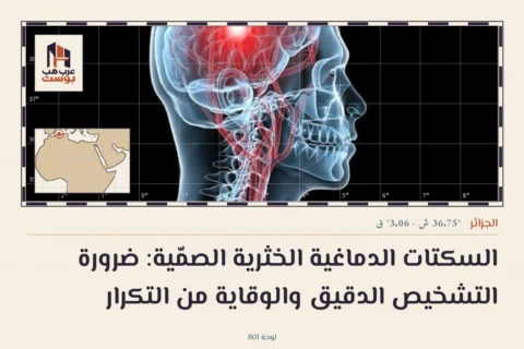 السكتات الدماغية الخثرية الصمّية: ضرورة التشخيص الدقيق والوقاية من التكرار