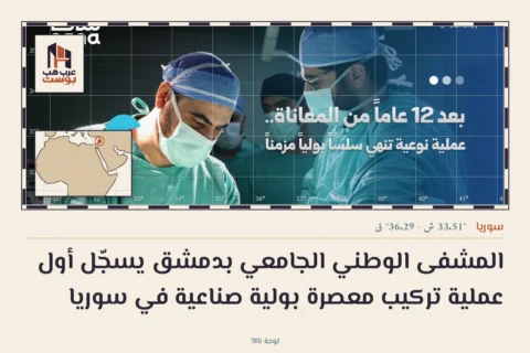 المشفى الوطني الجامعي بدمشق يسجّل أول عملية تركيب معصرة بولية صناعية في سوريا